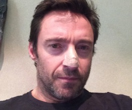 Hugh Jackman treated for cancer